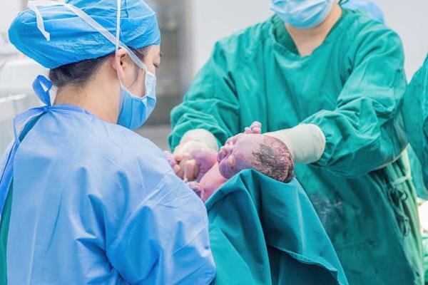 代理孕母剖腹产